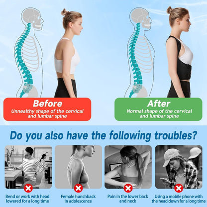 Posture Correction Belt